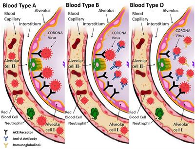 Effects of ABO blood groups and RH-factor on COVID-19 transmission, course and outcome: A review